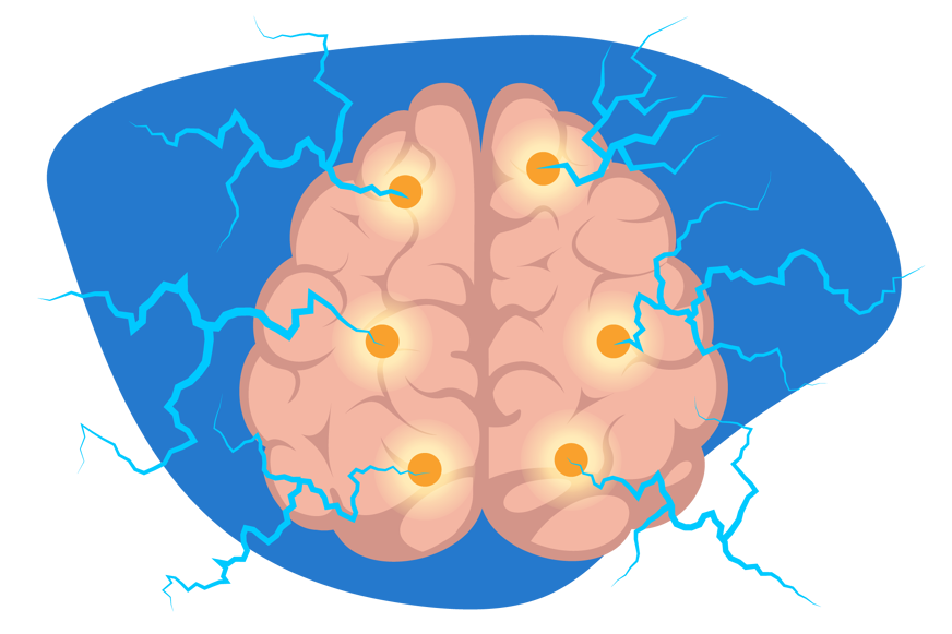 cerveau