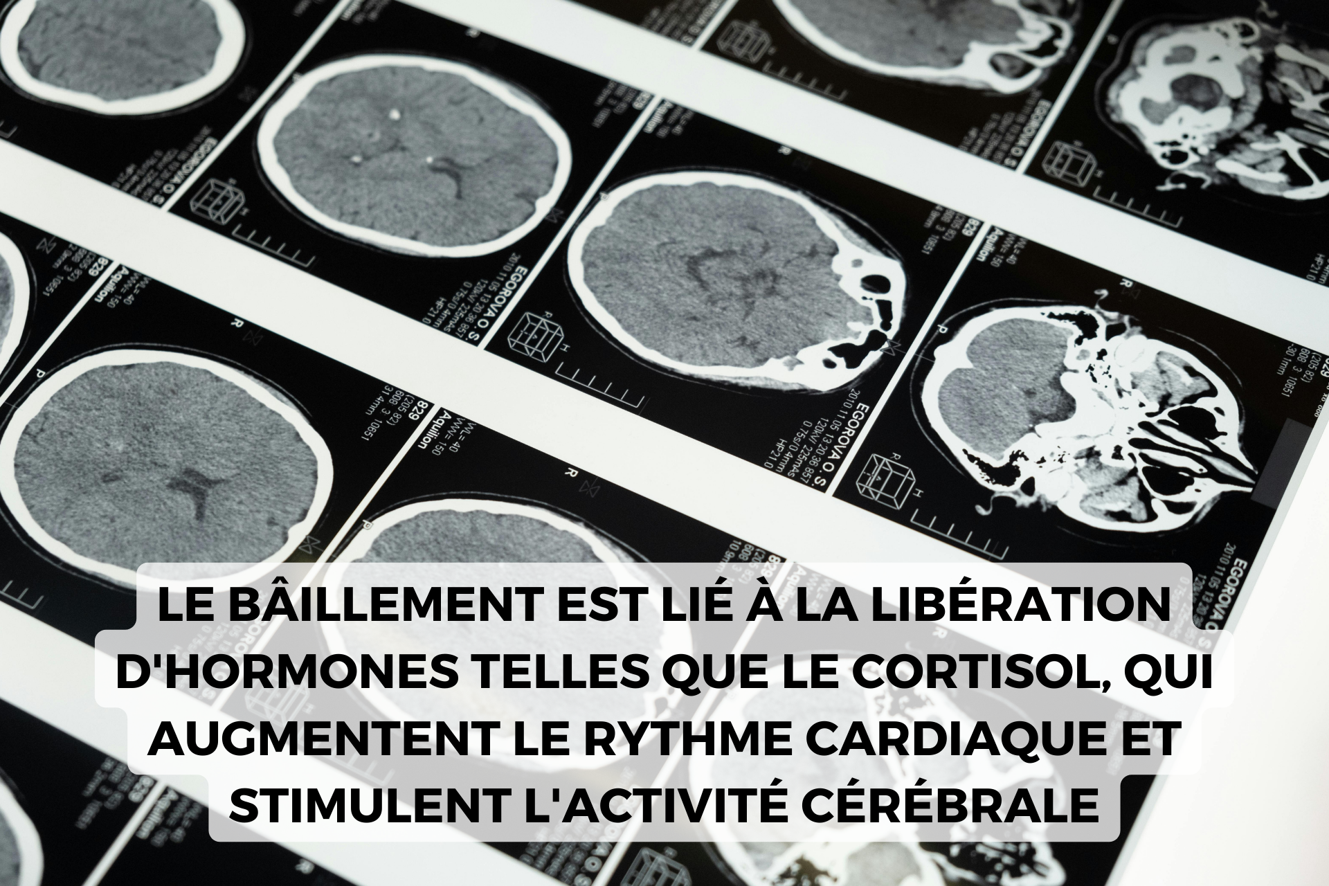 baillement cortisol