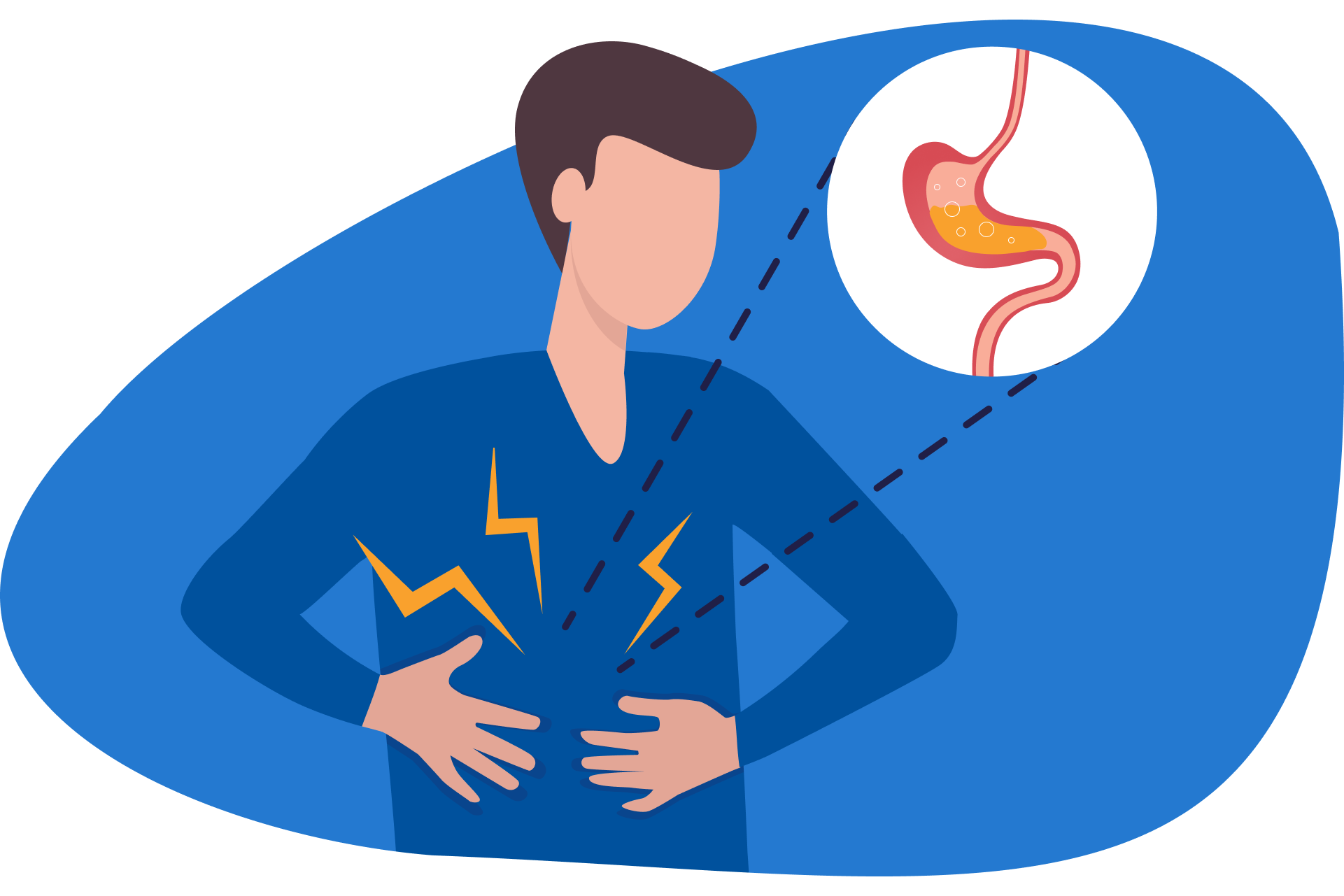 Reflux gastriques la nuit